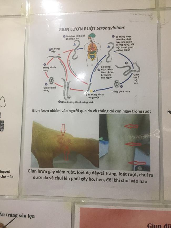 Con sốt triền miên không rõ nguyên nhân, mẹ đưa đi xét nghiệm mới tá hỏa biết con nhiễm loại kí sinh trùng kinh hãi