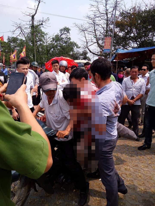 Vụ chủ nhà bị đánh nhập viện vì 7 người đi vệ sinh trả 5.000 đồng: Không có tiền hãy xin một câu