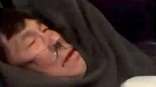 Bác sĩ Mỹ gốc Việt bị kéo lê khỏi máy bay lần đầu lên tiếng