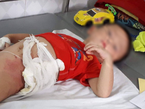 Hòa Bình: Cậu ruột ném cháu trai 4 tuổi vào đống lửa vì giành ăn quả dưa chuột