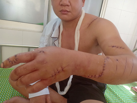 Bị chém trọng thương vì tranh cãi trong lúc đánh bài