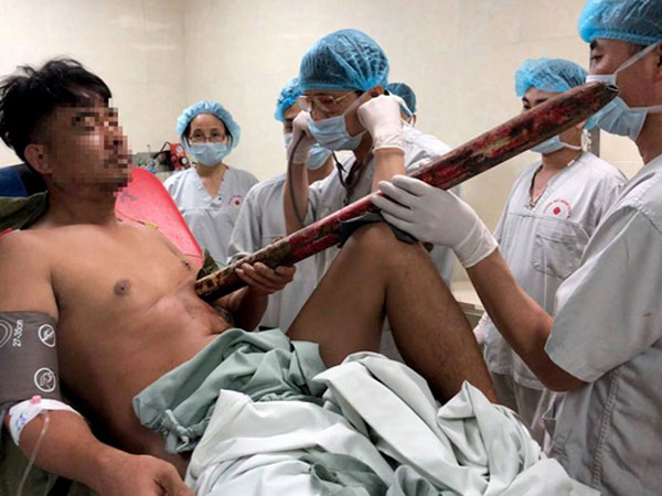 Nam thanh niên bị cột biển báo giao thông dài 2m đâm xuyên người