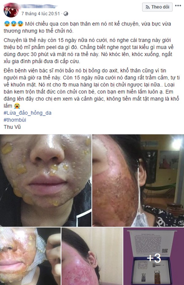 Kinh hãi hình ảnh cô gái bị nổi bóng nước khắp mặt vì làm đẹp: Chuyên gia cảnh báo điều quan trọng trước khi peel da