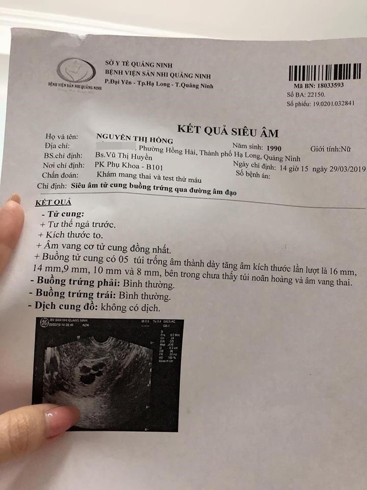 Bức thư chia tay nghẹn ngào người mẹ trẻ gửi đến 5 bào thai trong bụng, chưa kịp thành hình đã rời bỏ mẹ ra đi