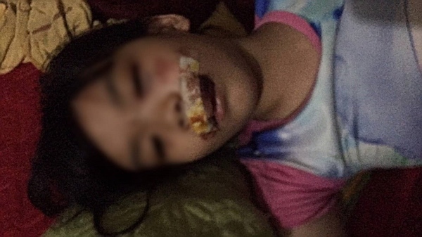 Chó điên lao vào cắn 5 người rồi lăn đùng ra chết