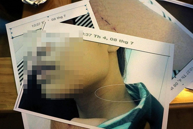 TP.HCM: Truy nã gã anh rể cưỡng bức em vợ là du học sinh Mỹ