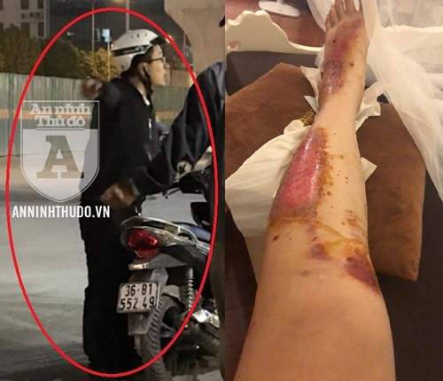 Nhiều cô gái làm đơn tố cáo đối tượng nghi bệnh hoạn, gây tai nạn giao thông để xâm hại phụ nữ