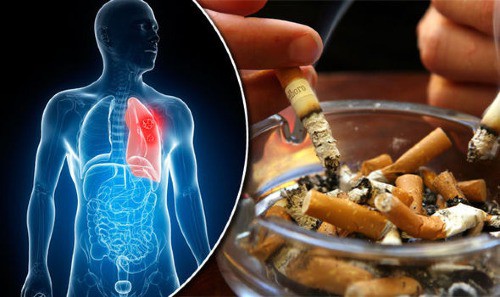 Con 15 tuổi đã mắc ung thư, bác sĩ chỉ đích danh thủ phạm là thói quen chết người của bố