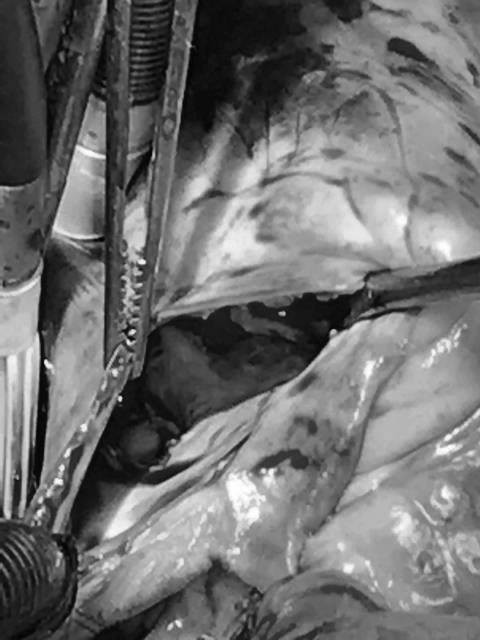 Kỳ lạ cô gái mắc tim bẩm sinh có phủ tạng đảo ngược được cứu sống ngoạn mục