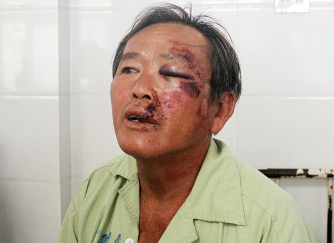 Vụ xe Lexus tông chết 4 người: Chưa đủ chứng cứ tạm giữ tài xế?