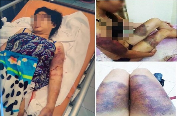 Rùng rợn lời kể của thai phụ bị bắt cóc, tra tấn suốt 20 ngày đến sẩy thai: Lúc con không còn đạp nữa, tôi năn nỉ thả về nhưng không được