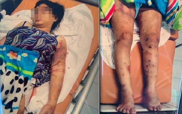 Vụ thai phụ bị tra tấn dã man suốt 20 ngày đến sẩy thai: Cha nạn nhân tiết lộ sự thật số tiền nợ một triệu mấy…