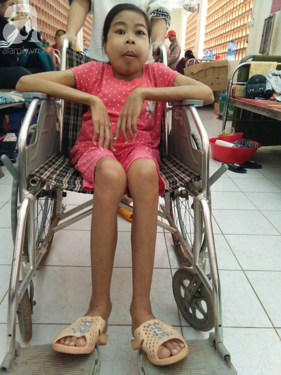 Bị suy thận nhưng vẫn cố giữ thai nhi, người mẹ bị biến dạng khuôn mặt, chấp nhận chết để con gái nhỏ được chào đời