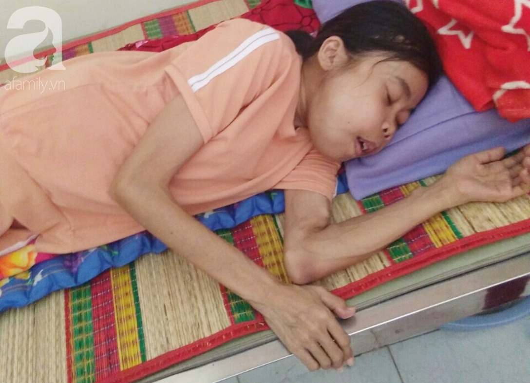 Bị suy thận nhưng vẫn cố giữ thai nhi, người mẹ bị biến dạng khuôn mặt, chấp nhận chết để con gái nhỏ được chào đời