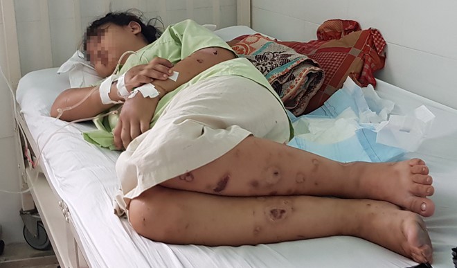 Em gái bị bắt giữ hành hạ đến sẩy thai, vì sao anh trai biết mà không cứu?