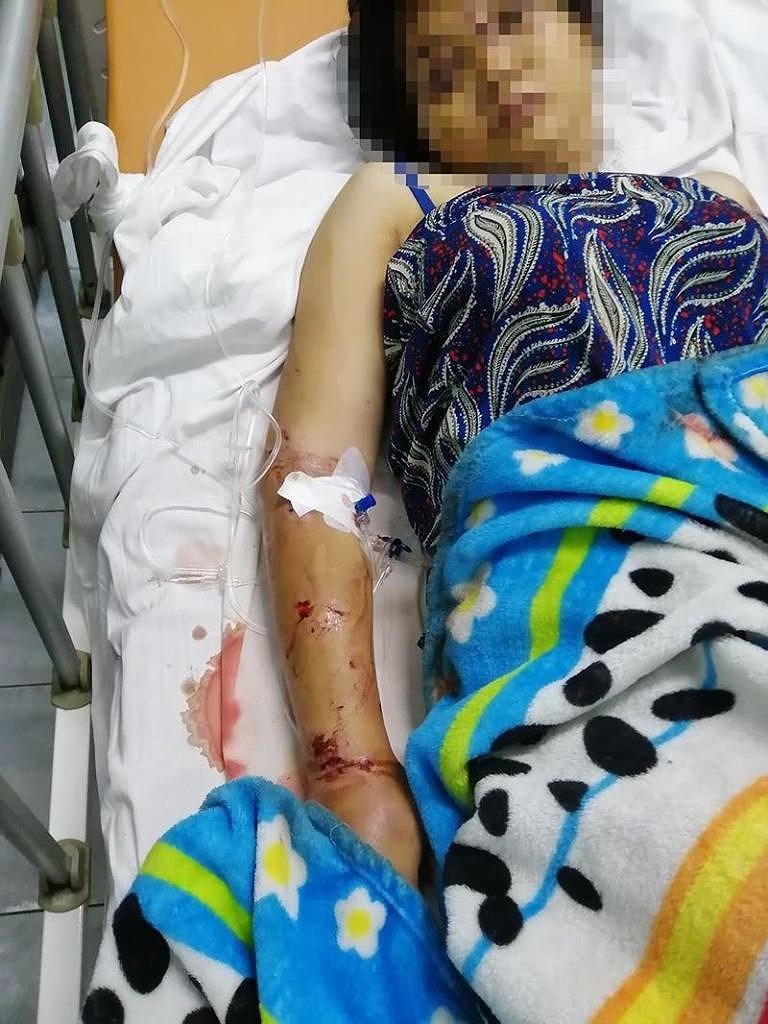 Khởi tố, bắt giam kẻ đánh đập, tra tấn dã man cô gái 18 tuổi