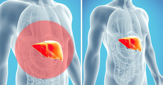 10 dấu hiệu cảnh báo cơ thể bị độc tố tấn công: Hãy nhanh thải độc ngay 10 dấu hiệu cảnh báo cơ thể bị độc tố tấn công: Hãy nhanh thải độc ngay