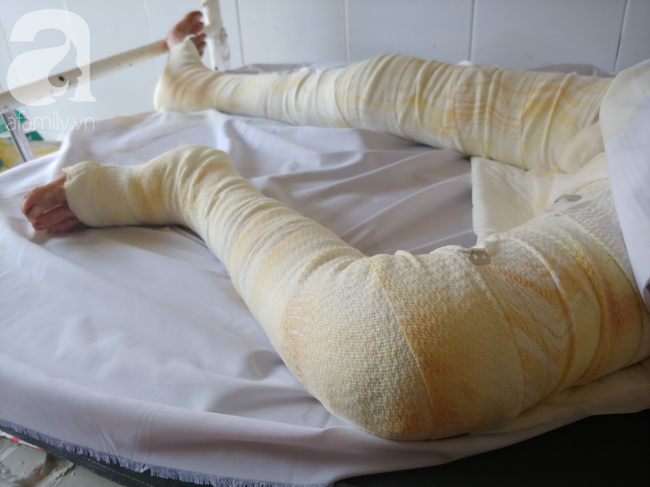 Dụ dỗ xin con nuôi không được, gã đàn ông dùng xăng đốt cháy người mẹ trẻ