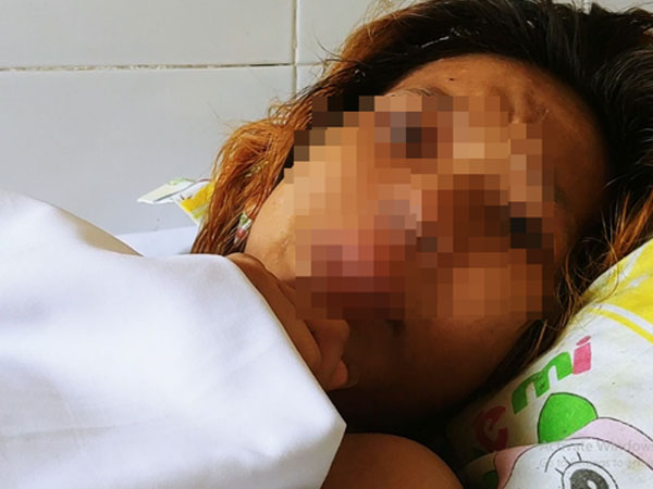 Dụ dỗ xin con nuôi không được, gã đàn ông dùng xăng đốt cháy người mẹ trẻ