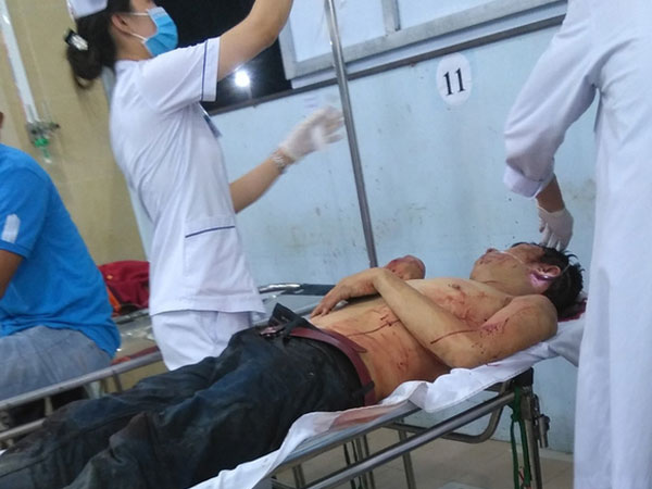 Bắt nghi phạm chém hàng xóm 17 nhát vì chê hát như nhạc đám ma