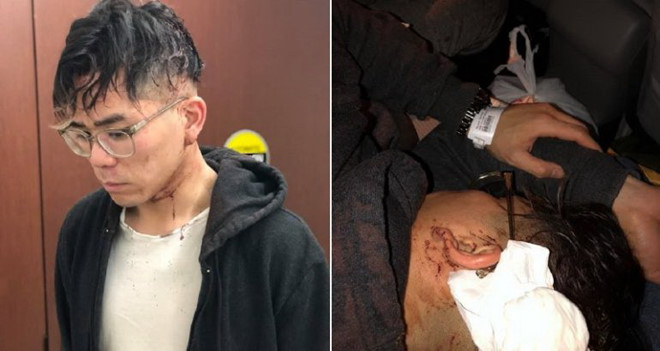 Chủ nhà hàng gốc Việt ở Mỹ bị tố hành hung nhân viên