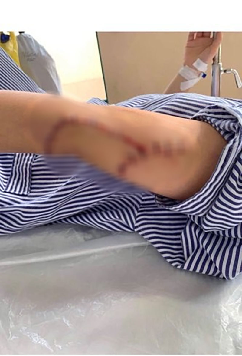 Cô gái rạch mặt khiến bạn cũ phải khâu 60 mũi trần tình: Q. đánh tôi trước, sao mọi người chỉ bênh cô ấy mà mạt sát tôi?