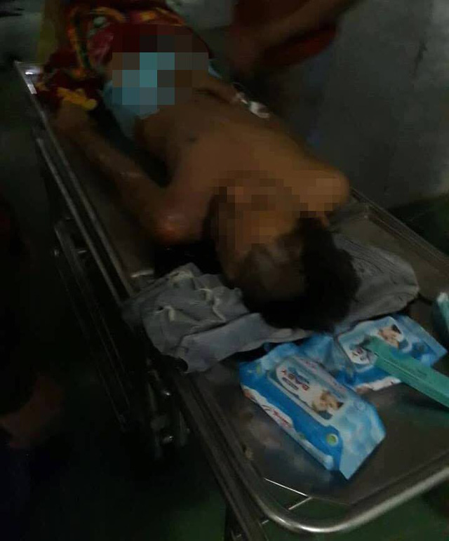 Thanh Hóa: Bị sét đánh, nam thanh niên thoát chết hy hữu