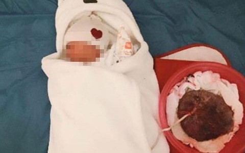 Dân mạng liên tục chia sẻ câu chuyện cặp vợ chồng tự đỡ đẻ tại nhà theo phương pháp thuận tự nhiên: Bộ Y tế cùng các chuyên gia đã nói gì?