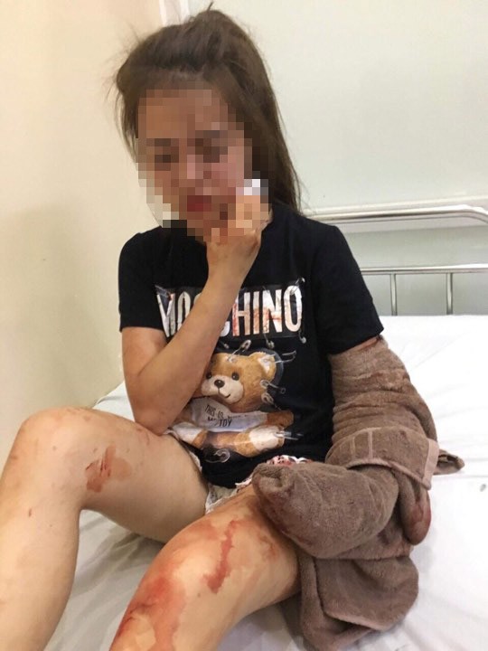 Nghe tin con gái rạch mặt người khác, mẹ ngã gục tại bệnh viện