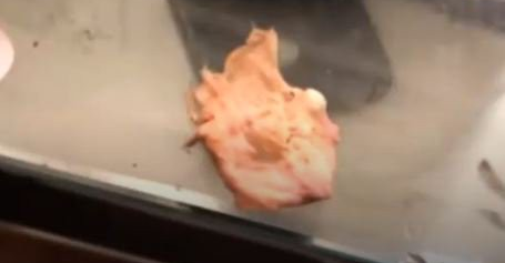 Cô gái khẳng định vừa hắt xì ra miếng bông băng bác sĩ bỏ quên khi sửa mũi, kiện phòng khám 346 triệu đồng