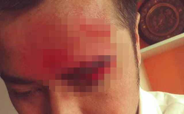 Phó giám đốc doanh nghiệp ở Sài Gòn bị đánh hội đồng khi đi đòi công nợ