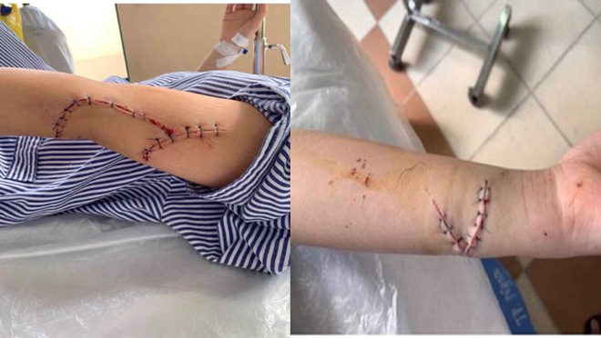 Những chi tiết rợn người qua lời kể của 2 cô gái tham gia vụ rạch mặt thiếu nữ xinh đẹp