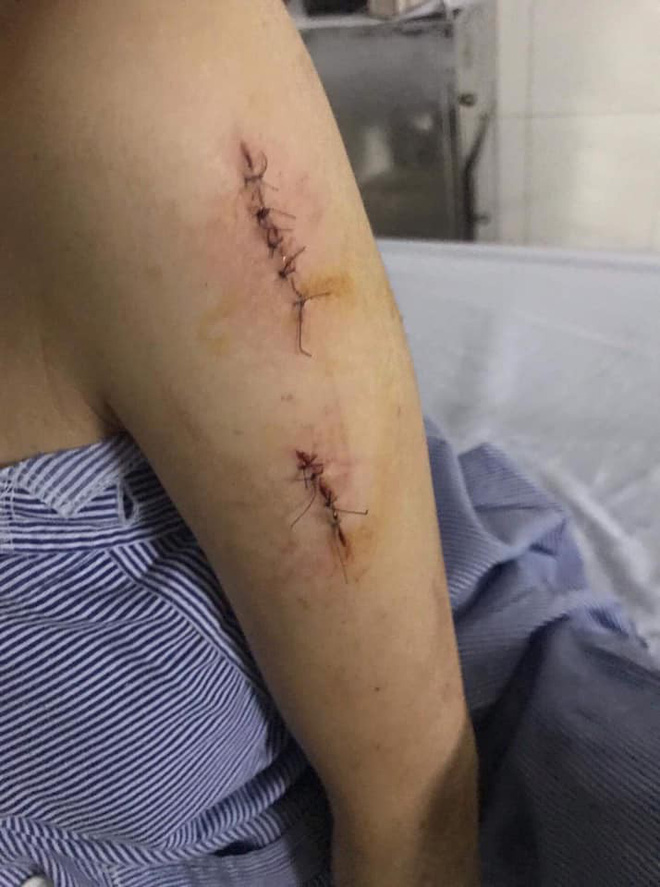 Những chi tiết rợn người qua lời kể của 2 cô gái tham gia vụ rạch mặt thiếu nữ xinh đẹp