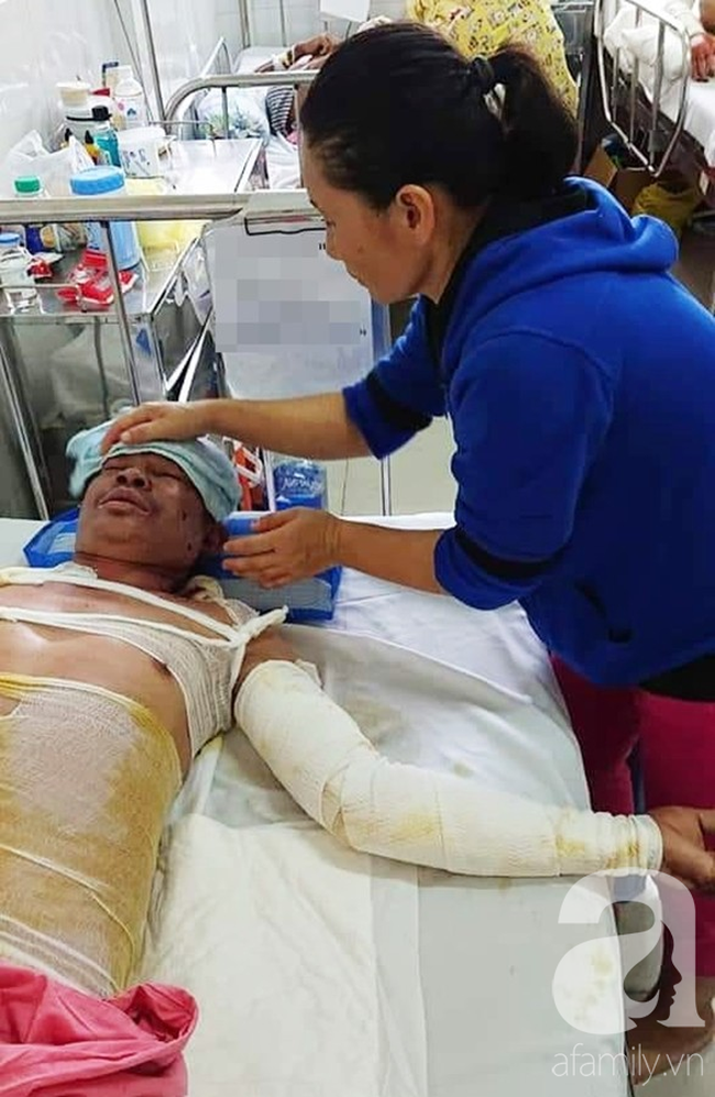 Chiết xăng xe để đi làm nuôi vợ con, người đàn ông bị bốc cháy, hóa thành ngọn đuốc sống