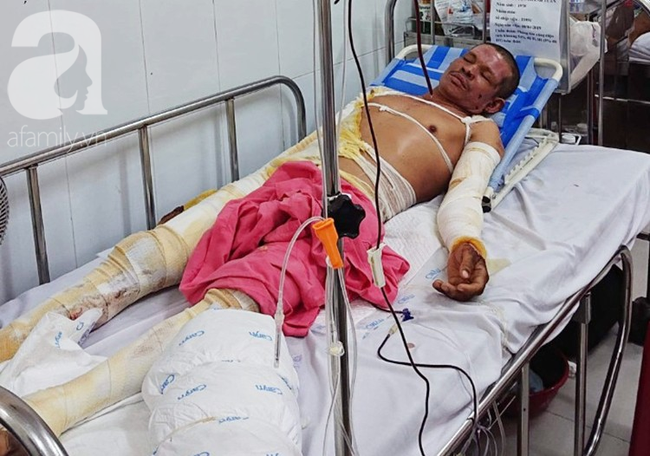 Chiết xăng xe để đi làm nuôi vợ con, người đàn ông bị bốc cháy, hóa thành ngọn đuốc sống