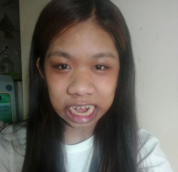 Cô gái không có nước mắt, không khép được răng