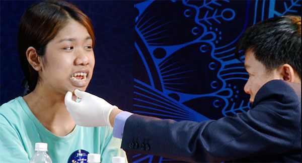 Cô gái không có nước mắt, không khép được răng