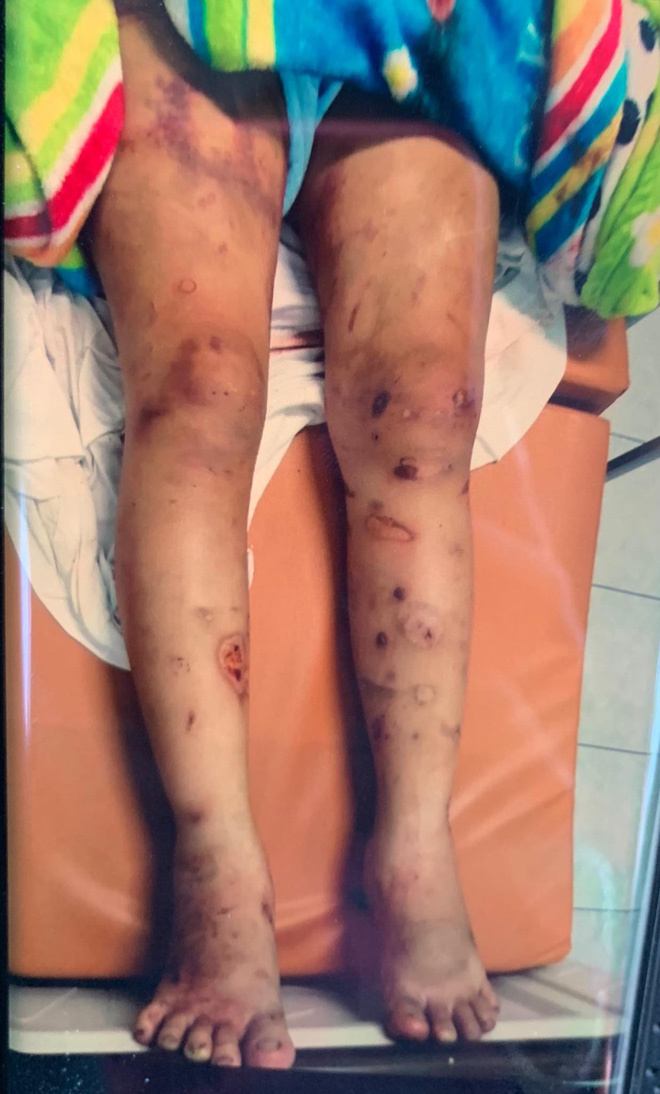 2 anh em chủ mưu vụ tra tấn bà bầu khai nạn nhân tới chơi nhưng hút ma túy, lấy trộm tiền