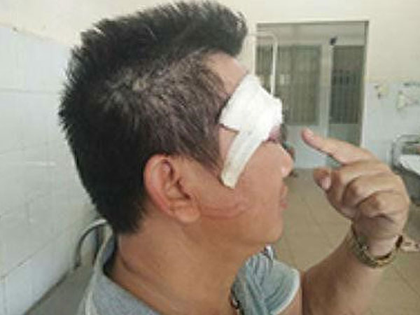 Bị truy sát bằng súng khi hẹn gặp người đến mua đất