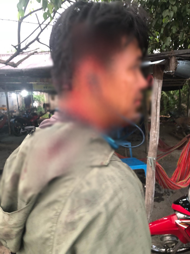 Lời khai của chủ quán đánh khách đổ máu vì thắc mắc hủ tiếu giá cắt cổ 100.000 đồng/tô