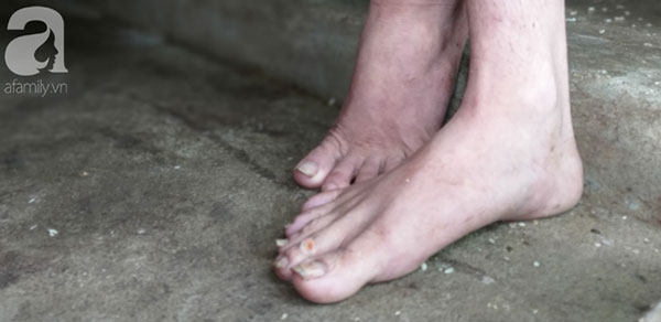 Cận cảnh chiếc chuồng của người bố nhốt con trai như vật nuôi, đầy ruồi muỗi và hôi thối được bạn bè giải cứu ở Hưng Yên