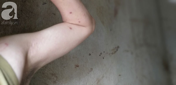 Cận cảnh chiếc chuồng của người bố nhốt con trai như vật nuôi, đầy ruồi muỗi và hôi thối được bạn bè giải cứu ở Hưng Yên