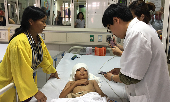 Bé trai bị chó cắn mất 2 tai đang được theo dõi chấn thương sọ não