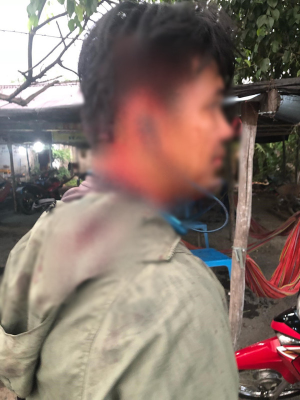 Nữ chủ quán gọi người đánh khách thắc mắc tô hủ tiếu 100.000 đồng từng vác dao chặn đầu xe xử tài xế ô tô vì suất cơm 35.000 đồng