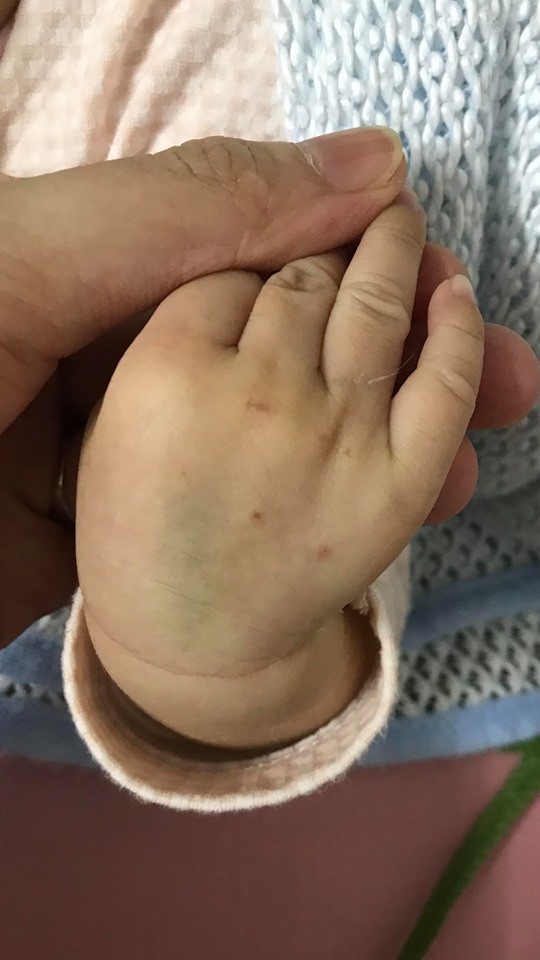 Sau hành trình cùng con chiến đấu lại virus RSV gây viêm phổi, mẹ Hà Nội cảnh báo các mẹ khác đừng coi thường nụ hôn thần chết