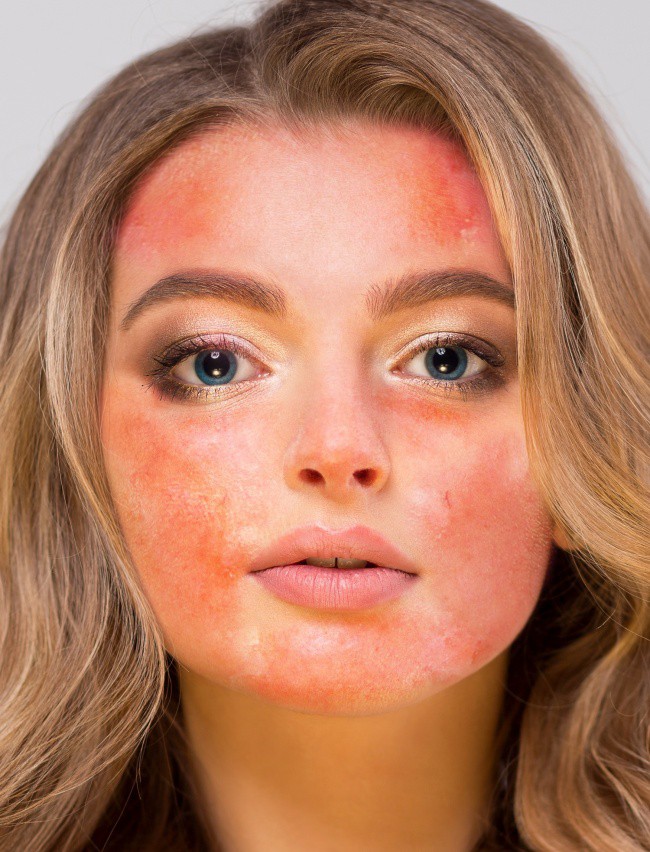 4 sản phẩm tự nhiên thường được khuyên để dưỡng da mặt nhưng thực ra lại gây hại không tưởng, chị em hãy nhớ kỹ