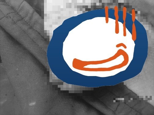 Tai nạn phòng the nhớ đời: Chàng trai 22 tuổi gãy súng vì thực hành tư thế khó trong ngày sinh nhật