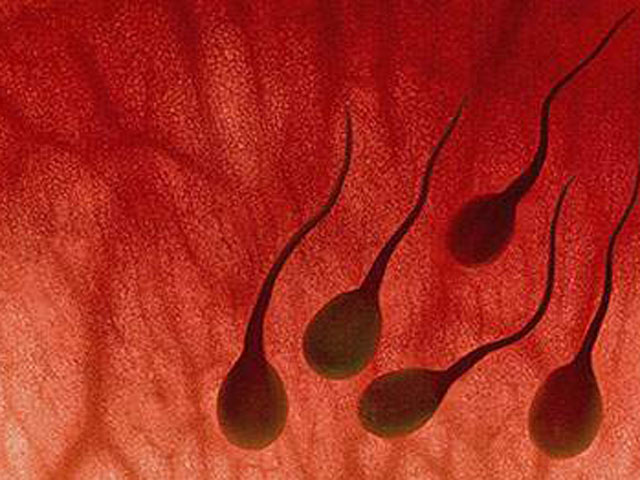 Xuất tinh có máu, dấu hiệu bệnh gì?