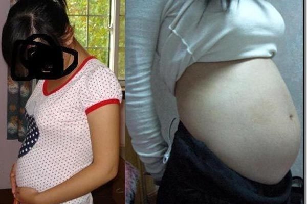 Những vụ nam sinh làm nhiều bạn học dính bầu khiến thế giới phát hoảng