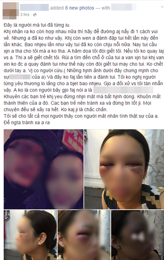 Sự thật bức ảnh cô dâu bị đánh thâm tím mặt mày vì tỏ thái độ lồi lõm, không cho chồng hôn ngay trong đám cưới